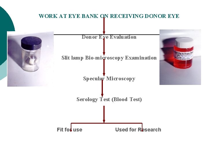 WORK AT EYE BANK ON RECEIVING DONOR EYE Donor Eye Evaluation Slit lamp Bio-microscopy