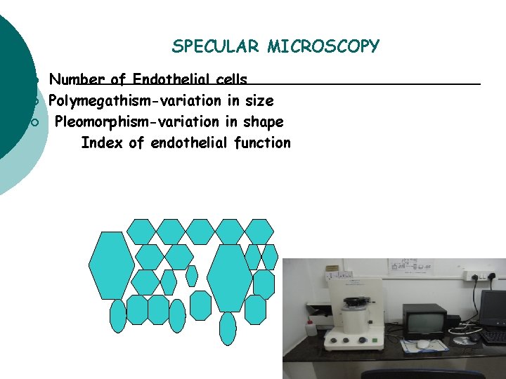 SPECULAR MICROSCOPY ¡ ¡ ¡ Number of Endothelial cells Polymegathism-variation in size Pleomorphism-variation in