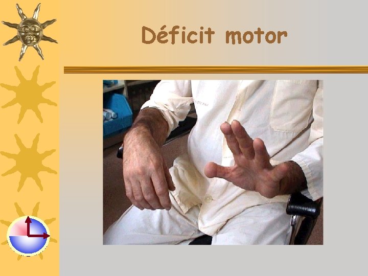 Déficit motor 