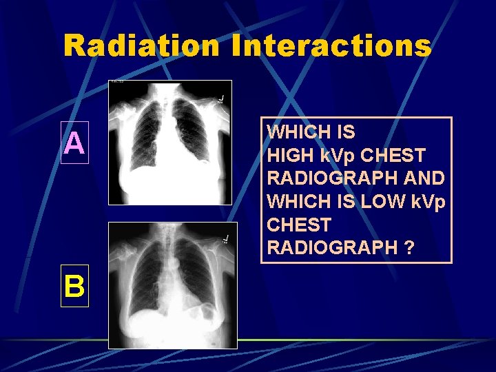 Radiation Interactions A B WHICH IS HIGH k. Vp CHEST RADIOGRAPH AND WHICH IS