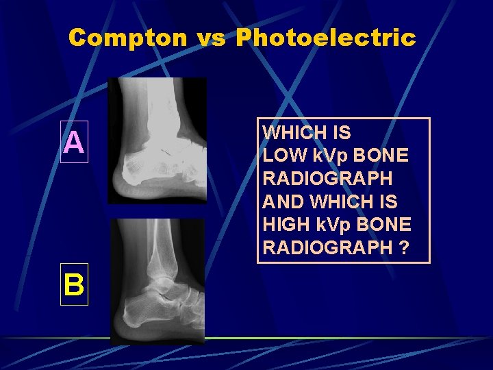 Compton vs Photoelectric A B WHICH IS LOW k. Vp BONE RADIOGRAPH AND WHICH