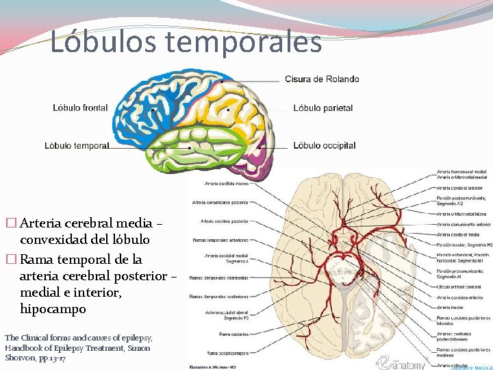 Lóbulos temporales � Arteria cerebral media – convexidad del lóbulo � Rama temporal de