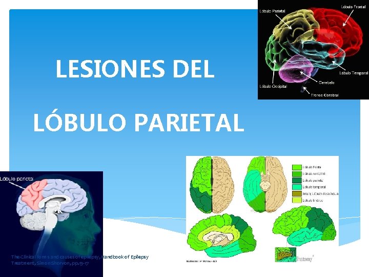 LESIONES DEL LÓBULO PARIETAL The Clinical forms and causes of epilepsy, Handbook of Epilepsy