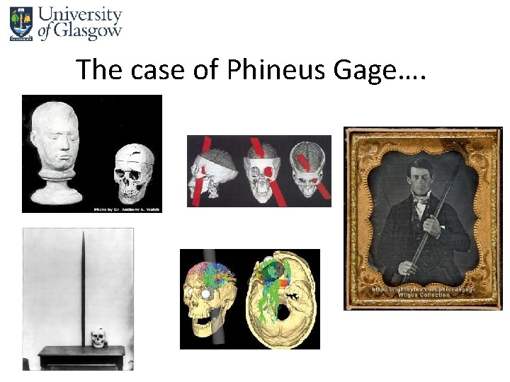 The case of Phineus Gage…. 