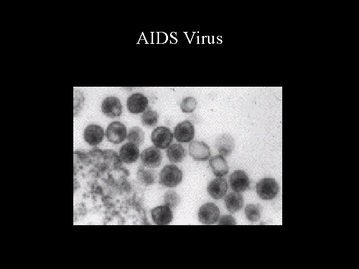 AIDS Virus 