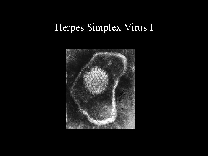 Herpes Simplex Virus I 