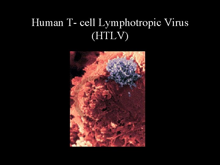 Human T- cell Lymphotropic Virus (HTLV) 