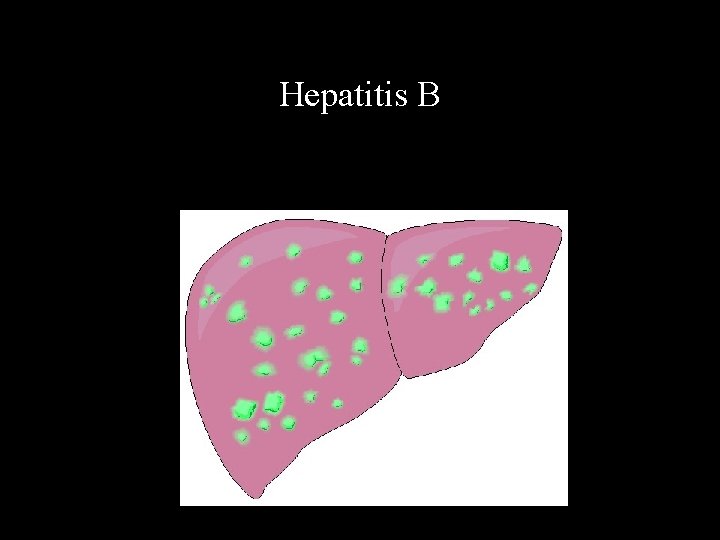 Hepatitis B 