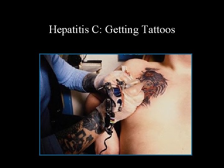 Hepatitis C: Getting Tattoos 