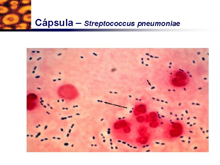 Cápsula – Streptococcus pneumoniae 
