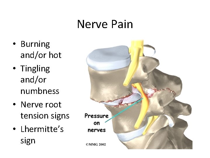 Nerve Pain • Burning and/or hot • Tingling and/or numbness • Nerve root tension