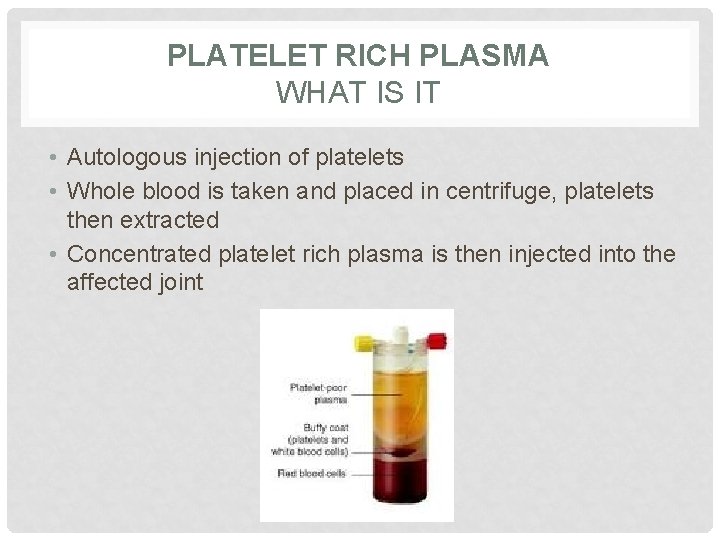 PLATELET RICH PLASMA WHAT IS IT • Autologous injection of platelets • Whole blood