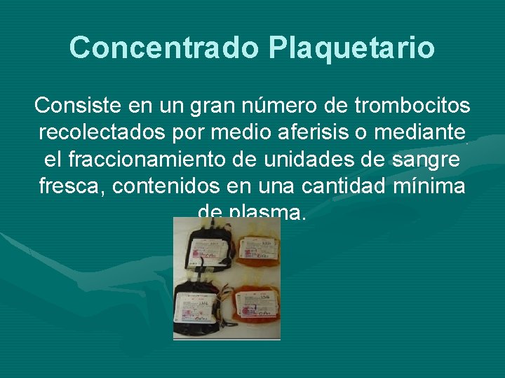 Concentrado Plaquetario Consiste en un gran número de trombocitos recolectados por medio aferisis o