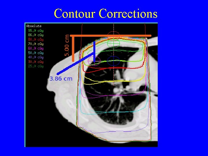 Contour Corrections 