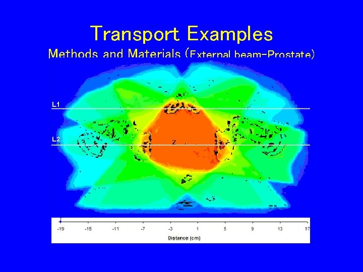 Transport Examples Methods and Materials (External beam-Prostate) 