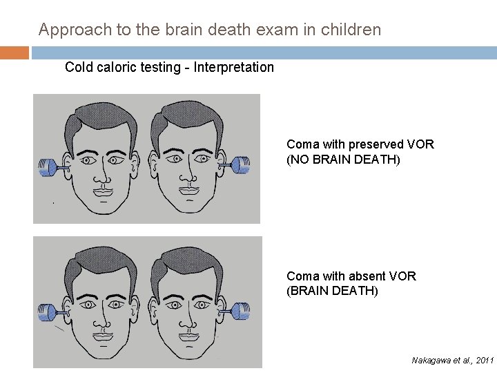 Approach to the brain death exam in children Cold caloric testing - Interpretation Coma
