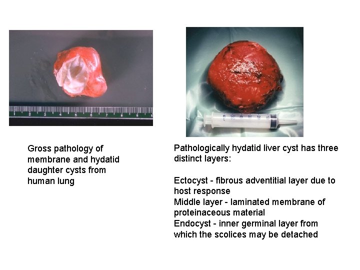 Tapeworms Diphyllobothrium latum fish tapeworm Taenia saginata beef
