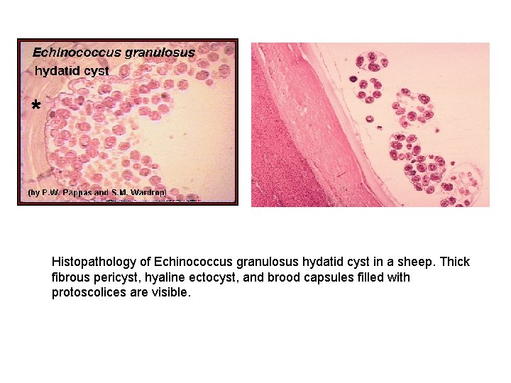 Histopathology of Echinococcus granulosus hydatid cyst in a sheep. Thick fibrous pericyst, hyaline ectocyst,