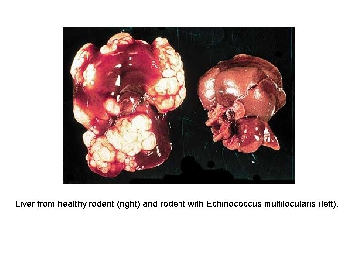 Liver from healthy rodent (right) and rodent with Echinococcus multilocularis (left). 