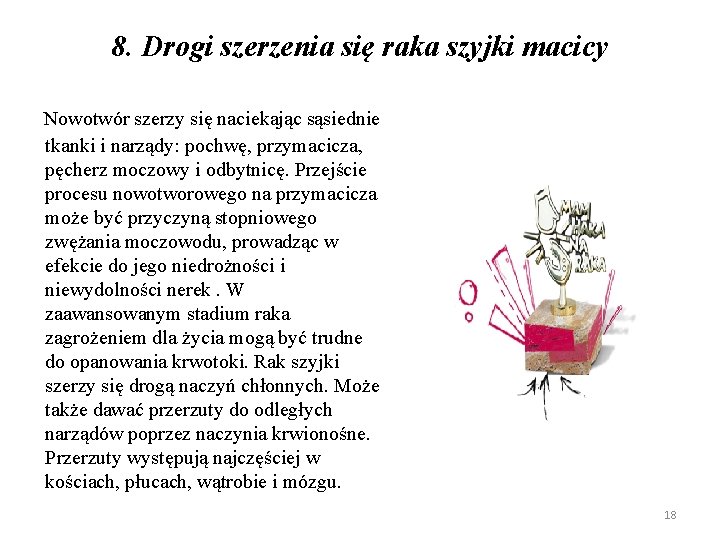 8. Drogi szerzenia się raka szyjki macicy Nowotwór szerzy się naciekając sąsiednie tkanki i 8. Drogi szerzenia się raka szyjki macicy Nowotwór szerzy się naciekając sąsiednie tkanki i
