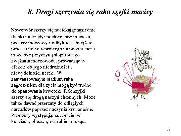 8. Drogi szerzenia się raka szyjki macicy Nowotwór szerzy się naciekając sąsiednie tkanki i