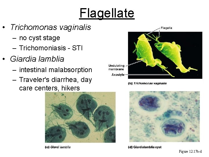 Flagellate • Trichomonas vaginalis – no cyst stage – Trichomoniasis - STI • Giardia Flagellate • Trichomonas vaginalis – no cyst stage – Trichomoniasis - STI • Giardia