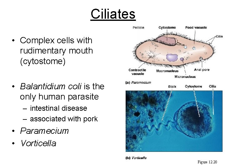 Ciliates • Complex cells with rudimentary mouth (cytostome) • Balantidium coli is the only