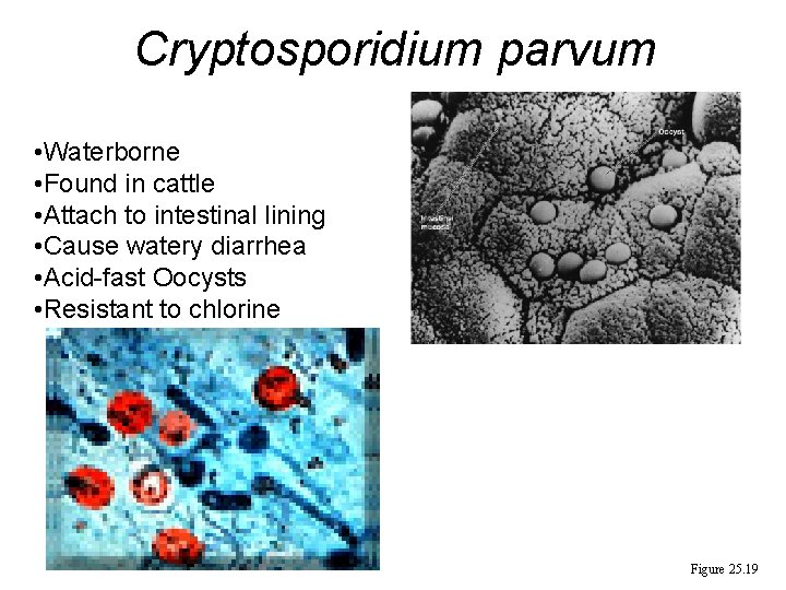 Cryptosporidium parvum • Waterborne • Found in cattle • Attach to intestinal lining •