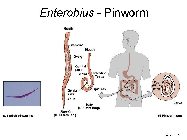 Enterobius - Pinworm Figure 12. 29 Enterobius - Pinworm Figure 12. 29