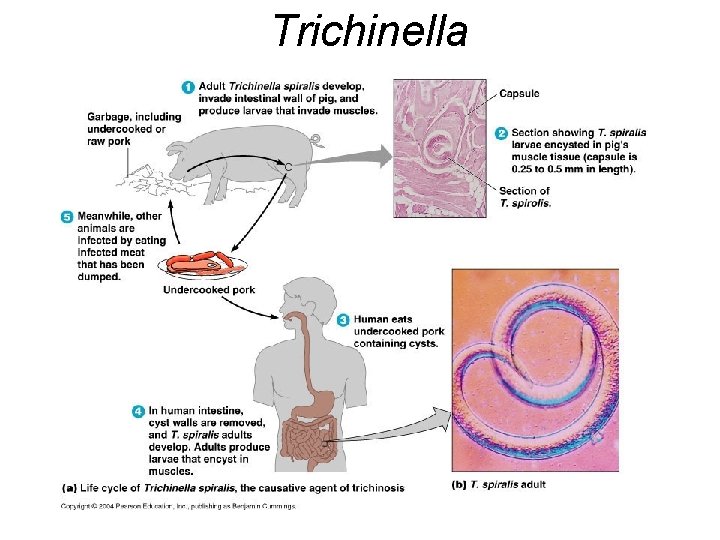 Trichinella Trichinella