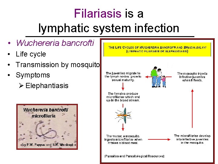 Filariasis is a lymphatic system infection • Wuchereria bancrofti • Life cycle • Transmission Filariasis is a lymphatic system infection • Wuchereria bancrofti • Life cycle • Transmission