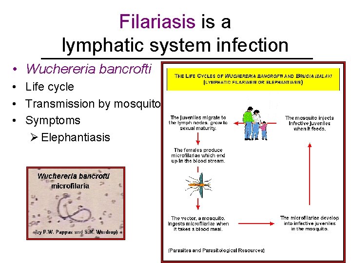 Filariasis is a lymphatic system infection • Wuchereria bancrofti • Life cycle • Transmission