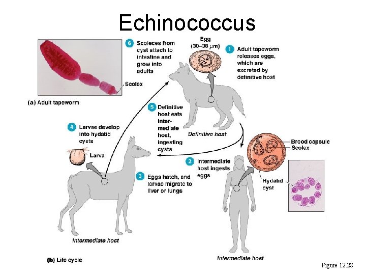 Echinococcus Figure 12. 28 Echinococcus Figure 12. 28