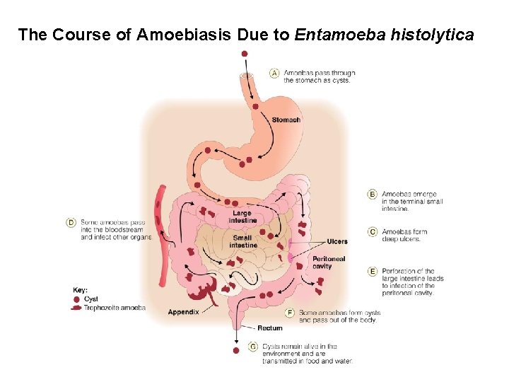 The Course of Amoebiasis Due to Entamoeba histolytica 