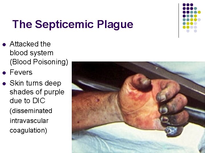 The Septicemic Plague l l l Attacked the blood system (Blood Poisoning) Fevers Skin