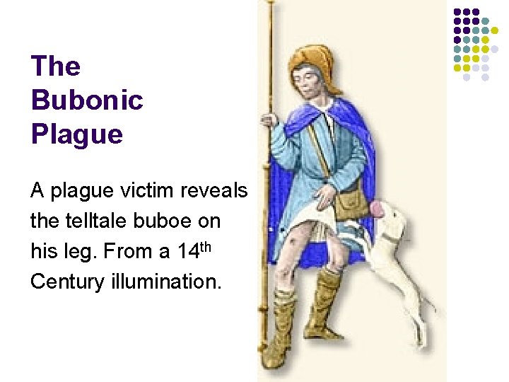 The Bubonic Plague A plague victim reveals the telltale buboe on his leg. From