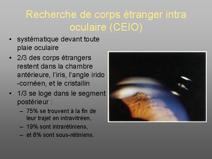 Recherche de corps étranger intra oculaire (CEIO) • systématique devant toute plaie oculaire •