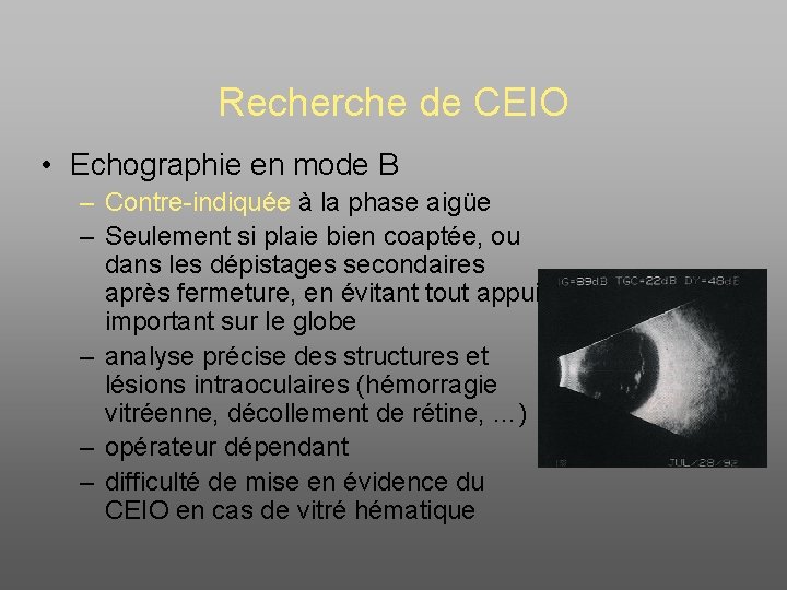 Recherche de CEIO • Echographie en mode B – Contre-indiquée à la phase aigüe