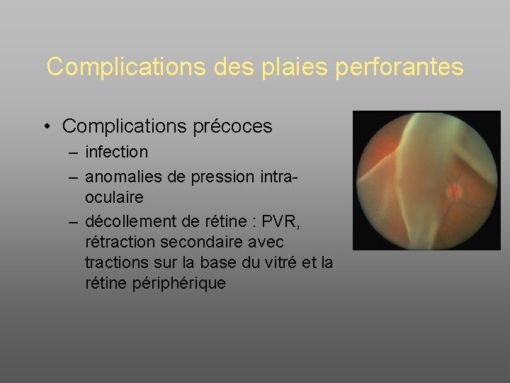 Complications des plaies perforantes • Complications précoces – infection – anomalies de pression intraoculaire
