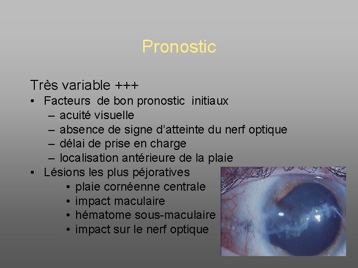 Pronostic Très variable +++ • Facteurs de bon pronostic initiaux – acuité visuelle –