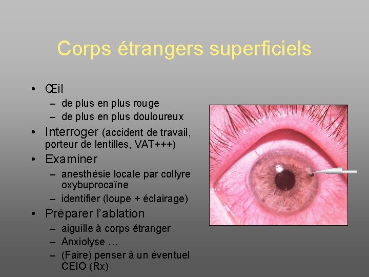 Corps étrangers superficiels • Œil – de plus en plus rouge – de plus