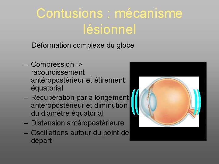 Contusions : mécanisme lésionnel Déformation complexe du globe – Compression -> racourcissement antéropostérieur et