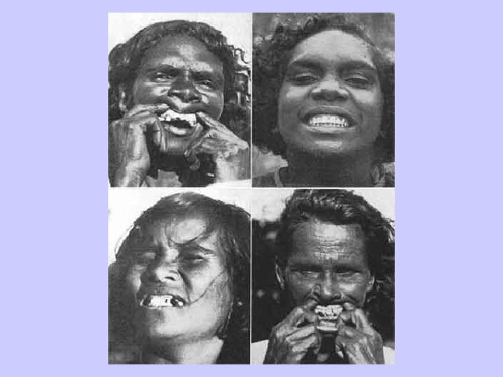 Aborigine Decay 