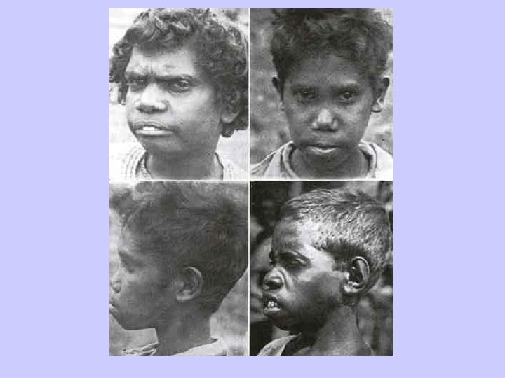 Aborigine 1 st Generation 