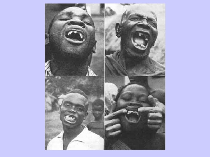 African Decay 