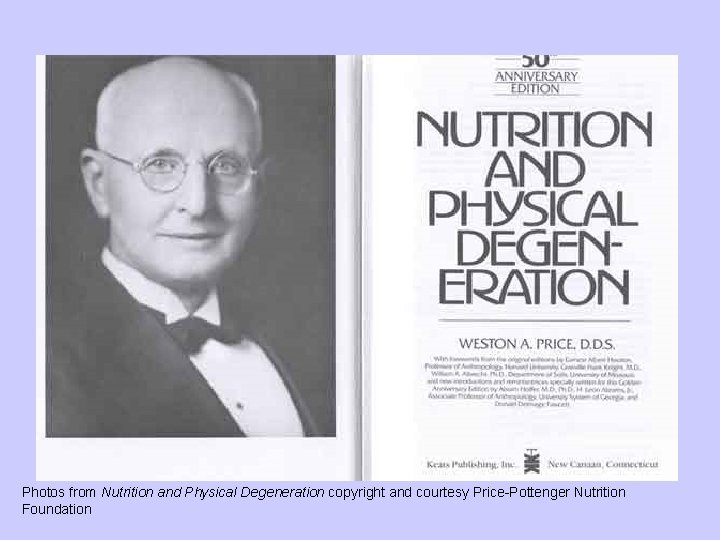 NPD Photos from Nutrition and Physical Degeneration copyright and courtesy Price-Pottenger Nutrition Foundation 