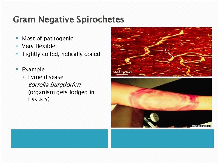 Gram Negative Spirochetes Most of pathogenic Very flexible Tightly coiled, helically coiled Example ◦
