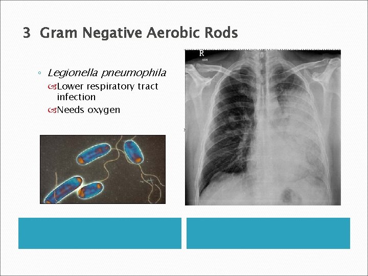 3 Gram Negative Aerobic Rods ◦ Legionella pneumophila Lower respiratory tract infection Needs oxygen