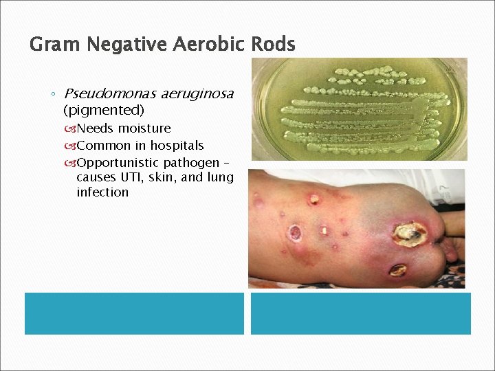 Gram Negative Aerobic Rods ◦ Pseudomonas aeruginosa (pigmented) Needs moisture Common in hospitals Opportunistic