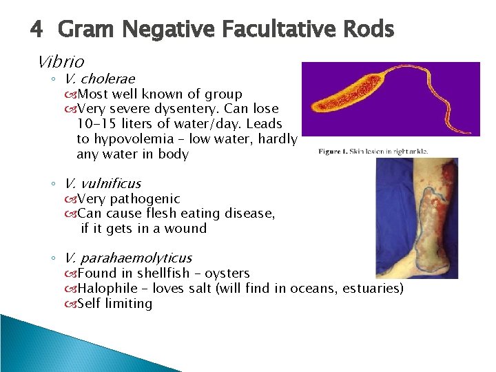 4 Gram Negative Facultative Rods Vibrio ◦ V. cholerae Most well known of group